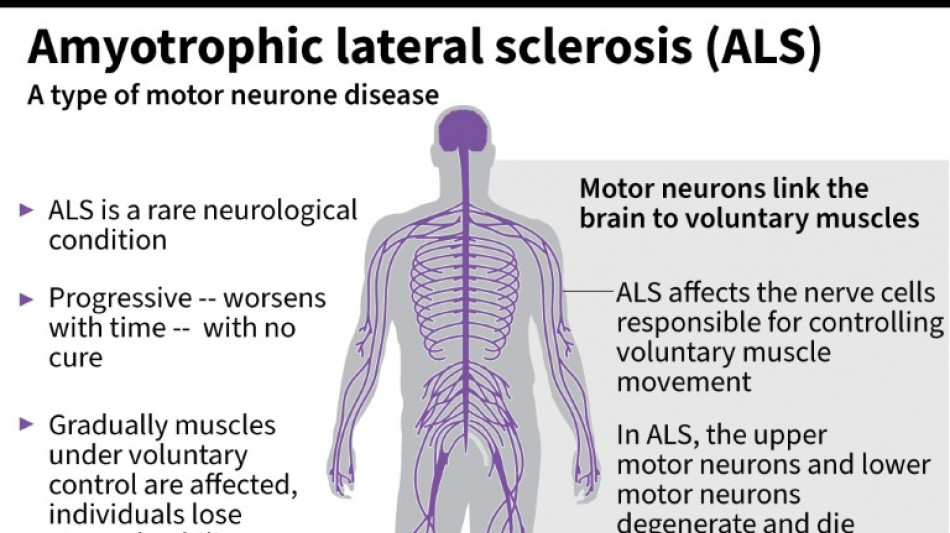 US company withdraws ALS drug after it fails in trial