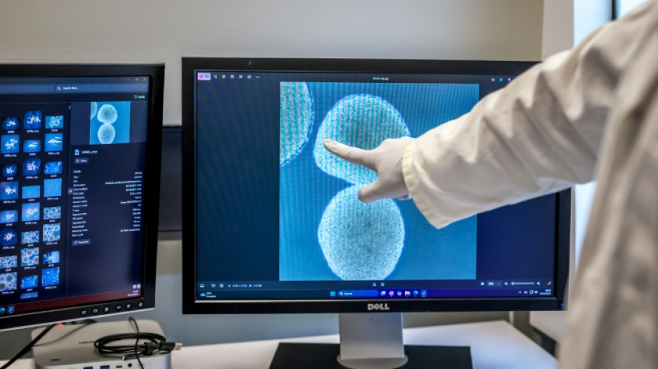 "Wetware", ces mini-cerveaux humains utilis&eacute;s dans des ordinateurs