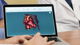 Cardiologia, svolta con le tecniche soft per la cura delle valvole cardiache