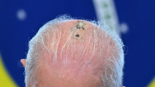 Lula inizia la radioterapia dopo l'asportazione del tumore cutaneo
