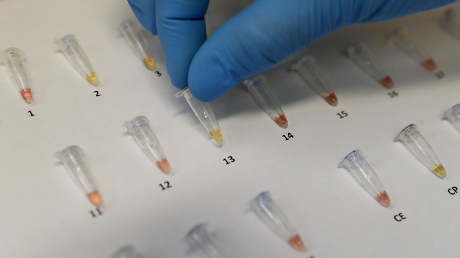 Salute: startup Singapore si espande in Usa con test anti-cancro