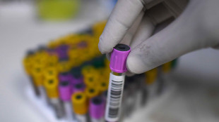 Da un'infusione di staminali beneficio duraturo in pazienti con rara malattia genetica